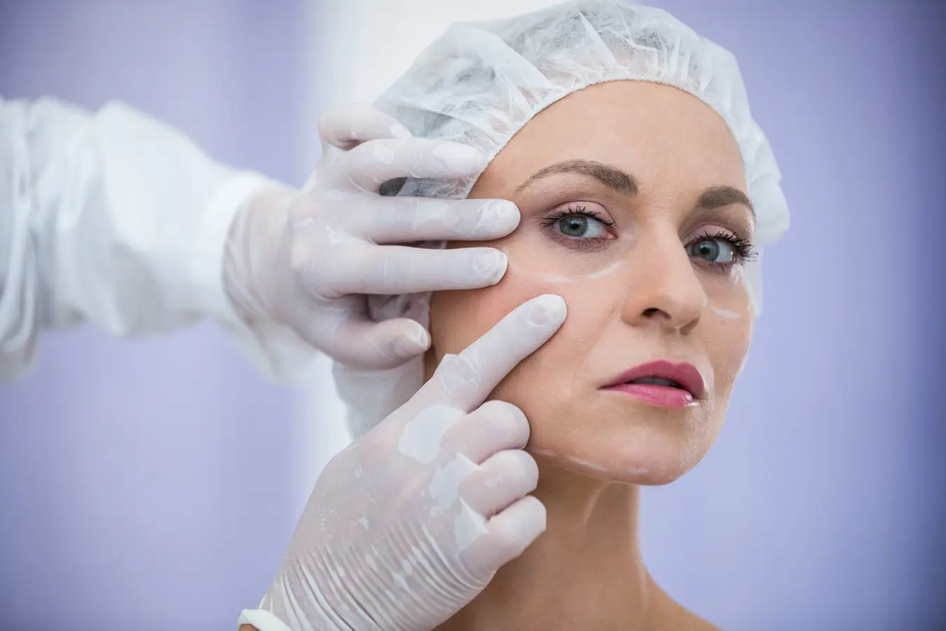 ¿Qué es mejor para la flacidez del rostro: hilos tensores o Radiesse?